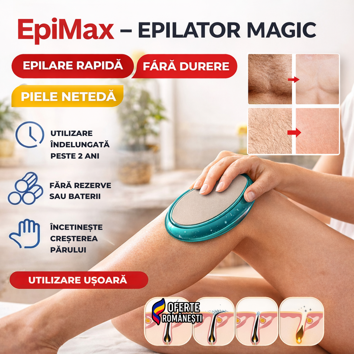 EpiMax - Epilator Magic